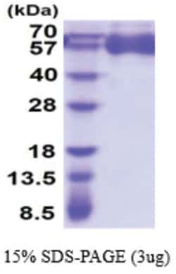Novus Biologicals&trade;&nbsp;Recombinant Human DC-LAMP His Protein