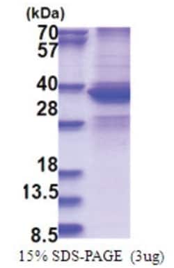 Novus Biologicals&trade;&nbsp;Recombinant Human DDX39 His Protein
