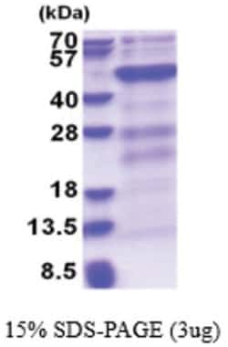 Novus Biologicals&trade;&nbsp;Recombinant Human Dnmt3L His Protein