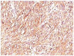 DOG1/TMEM16A Antibody (DG1/447 + DOG-1.1), Novus Biologicals:Antibodies:Primary
