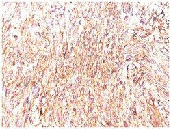 DOG1/TMEM16A Antibody (SPM580), Novus Biologicals 0.1mg; Unlabeled:Antibodies,