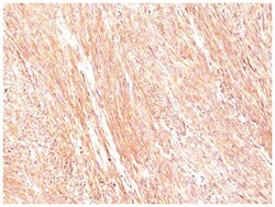 DOG1/TMEM16A Antibody (SPM580), Novus Biologicals 0.1mg; Unlabeled:Antibodies,