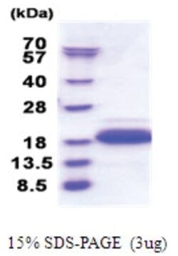 Novus Biologicals&trade;&nbsp;Recombinant Human DPY30 His Protein