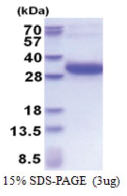 Novus Biologicals Recombinant Human DSU His Protein 0.05 mg | Buy Online | Novus Biologicals&trade; | Fisher Scientific