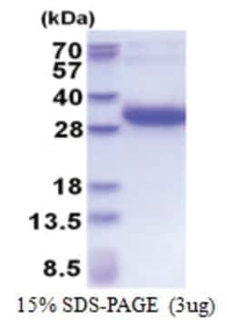 Novus Biologicals Recombinant Human DSU His Protein 0.05 mg | Buy Online | Novus Biologicals&trade; | Fisher Scientific