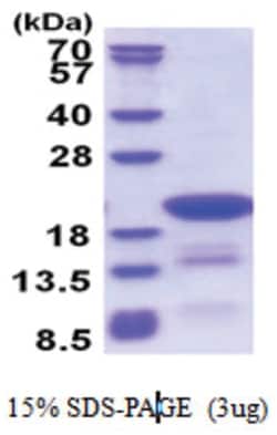 Novus Biologicals&trade;&nbsp;Recombinant Human DTD2 His Protein