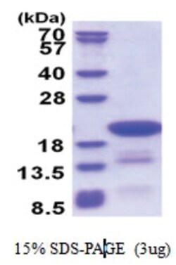 Novus Biologicals Recombinant Human DTD2 His Protein 0.5 mg | Buy Online | Novus Biologicals&trade; | Fisher Scientific
