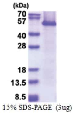 Novus Biologicals Recombinant Human eEF1A1 Protein 0.1 mg | Buy Online | Novus Biologicals&trade; | Fisher Scientific