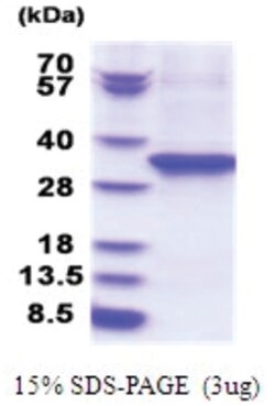 Novus Biologicals&trade;&nbsp;Recombinant Human eEF-2 His Protein