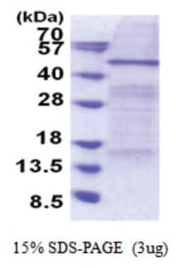 Novus Biologicals&trade;&nbsp;Recombinant Human Elp4 His Protein