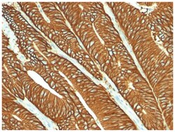 EpCAM/TROP1 Mouse, Clone: SPM134, Novus Biologicals:Antibodies:Primary