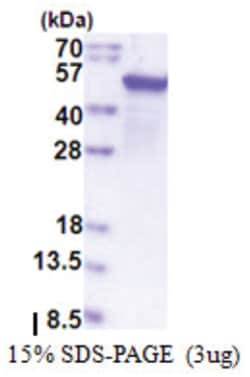 Novus Biologicals&trade;&nbsp;Recombinant Human EPHX1 T7 Protein