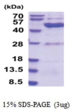 Novus Biologicals Recombinant Human ETNK2 His Protein 0.01mg:Recombinant