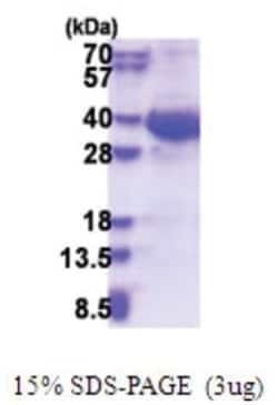 Novus Biologicals&trade;&nbsp;Recombinant Human Exosome component 8 His Protein