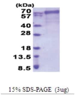 Novus Biologicals Recombinant Human FARSB His Protein 0.5 mg | Buy Online | Novus Biologicals&trade; | Fisher Scientific