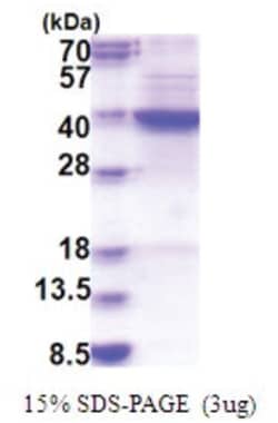 Novus Biologicals Recombinant Human FDFT1 His Protein 0.05 mg | Buy Online | Novus Biologicals&trade; | Fisher Scientific
