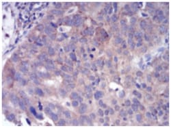 FGFR3 Antibody (2H10B4) - BSA Free, Novus Biologicals:Antibodies:Primary
