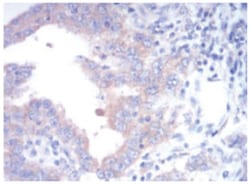 FGFR3 Antibody (2H10B4) - BSA Free, Novus Biologicals:Antibodies:Primary