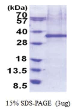 Novus Biologicals Recombinant Human FHL2 His Protein 0.5 mg | Buy Online | Novus Biologicals&trade; | Fisher Scientific