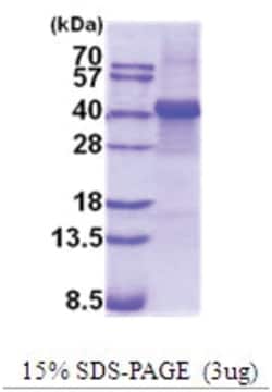 Novus Biologicals&trade;&nbsp;Recombinant Human Fibrinogen beta chain His Protein