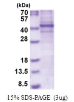 Novus Biologicals&trade;&nbsp;Recombinant Human FRA2 His Protein