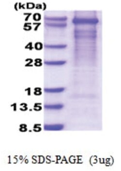 Novus Biologicals Recombinant Human GAD1/GAD67 His Protein 0.5 mg | Buy Online | Novus Biologicals&trade; | Fisher Scientific