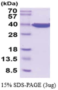 Novus Biologicals&trade;&nbsp;Recombinant Human GAPDH Protein