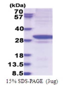 Novus Biologicals&trade;&nbsp;Recombinant Human GARS His Protein