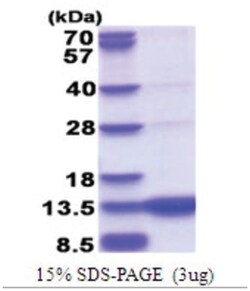 Novus Biologicals&trade;&nbsp;Recombinant Human GCHFR His Protein