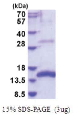 Novus Biologicals&trade;&nbsp;Recombinant Mouse GDF-15 His Protein