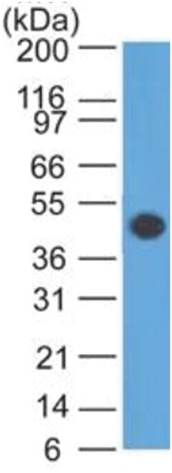 GFAP Mouse, Clone: SPM248, Novus Biologicals:Antibodies:Primary Antibodies