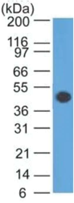GFAP Mouse, Clone: SPM507, Novus Biologicals 0.02mg; Unlabeled:Antibodies,