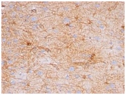 GFAP Mouse, Clone: SPM248, Novus Biologicals:Antibodies:Primary Antibodies