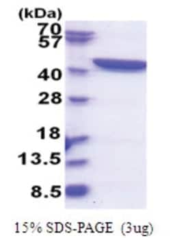 Novus Biologicals Recombinant Human GFPT1 His Protein 0.1 mg | Buy Online | Novus Biologicals&trade; | Fisher Scientific