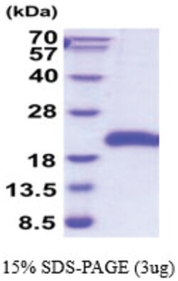 Novus Biologicals&trade;&nbsp;Recombinant Human GITR/TNFRSF18 His Protein