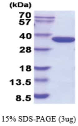 Novus Biologicals Recombinant E. coli Glucokinase/GCK His Protein 0.1 mg | Buy Online | Novus Biologicals&trade; | Fisher Scientific