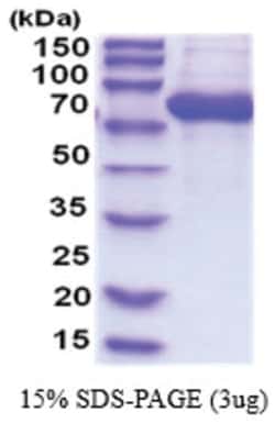 Novus Biologicals Recombinant Human Glucosylceramidase/GBA His Protein 0.25 mg | Buy Online | Novus Biologicals&trade; | Fisher Scientific
