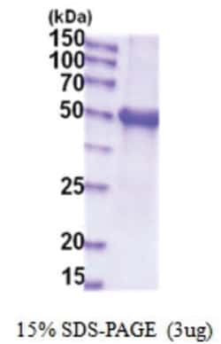 Novus Biologicals&trade;&nbsp;Recombinant Human Glucuronosyltransferase 1A1/UGT1A1 His Protein