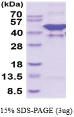 Novus Biologicals&trade;&nbsp;Recombinant Human Glutamine Synthetase His Protein