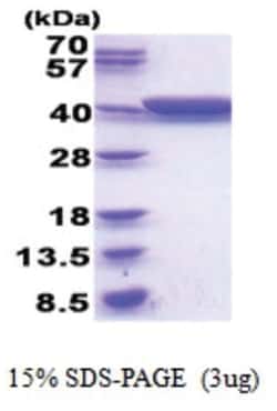 Novus Biologicals&trade;&nbsp;Recombinant E. coli Glycerol dehydrogenase His Protein
