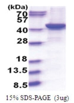 Novus Biologicals&trade;&nbsp;Recombinant Human GNAQ His Protein