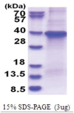 Novus Biologicals&trade;&nbsp;Recombinant Human GNB1 His Protein