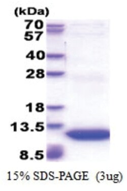 Novus Biologicals Recombinant Human GNG11 His Protein 0.5 mg | Buy Online | Novus Biologicals&trade; | Fisher Scientific