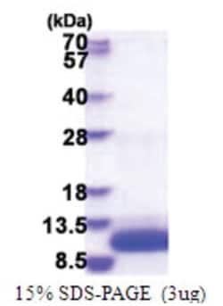 Novus Biologicals&trade;&nbsp;Recombinant Human GNGT1 His Protein