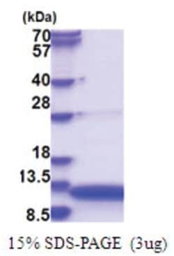 Novus Biologicals&trade;&nbsp;Recombinant Human GnRH His Protein