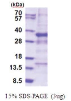 Novus Biologicals&trade;&nbsp;Recombinant Human GTF3C6 His Protein