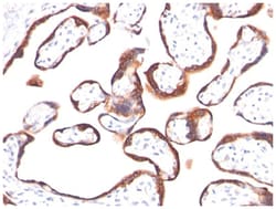 Chorionic Gonadotropin beta Chain (hCG beta) Antibody (HCGb/459), Novus