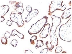 Chorionic Gonadotropin beta Chain (hCG beta) Antibody (HCGb/54+ HCGb/459),