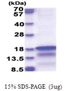 Novus Biologicals&trade;&nbsp;Recombinant HCV-Core His Protein