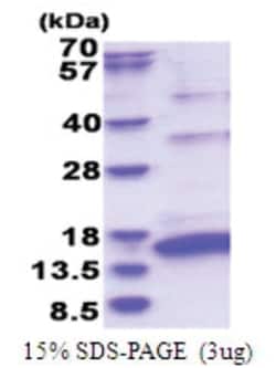 Novus Biologicals&trade;&nbsp;Recombinant HCV-NS5a His Protein